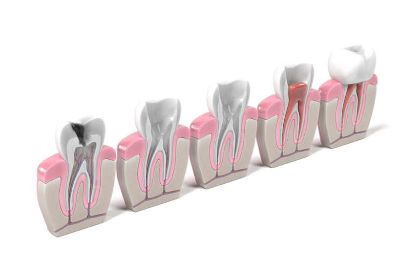 Restorative dentistry and endodontics